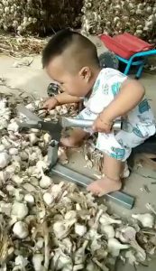 Bebé chino con cizalla